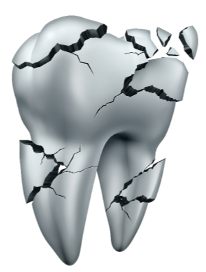 Cracked Tooth