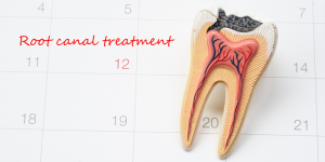 root canal on calendar